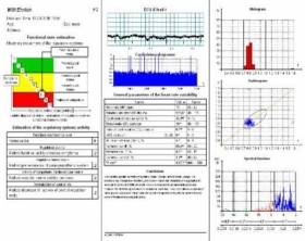 Kardivar - vyšetření variability srdečního rytmu